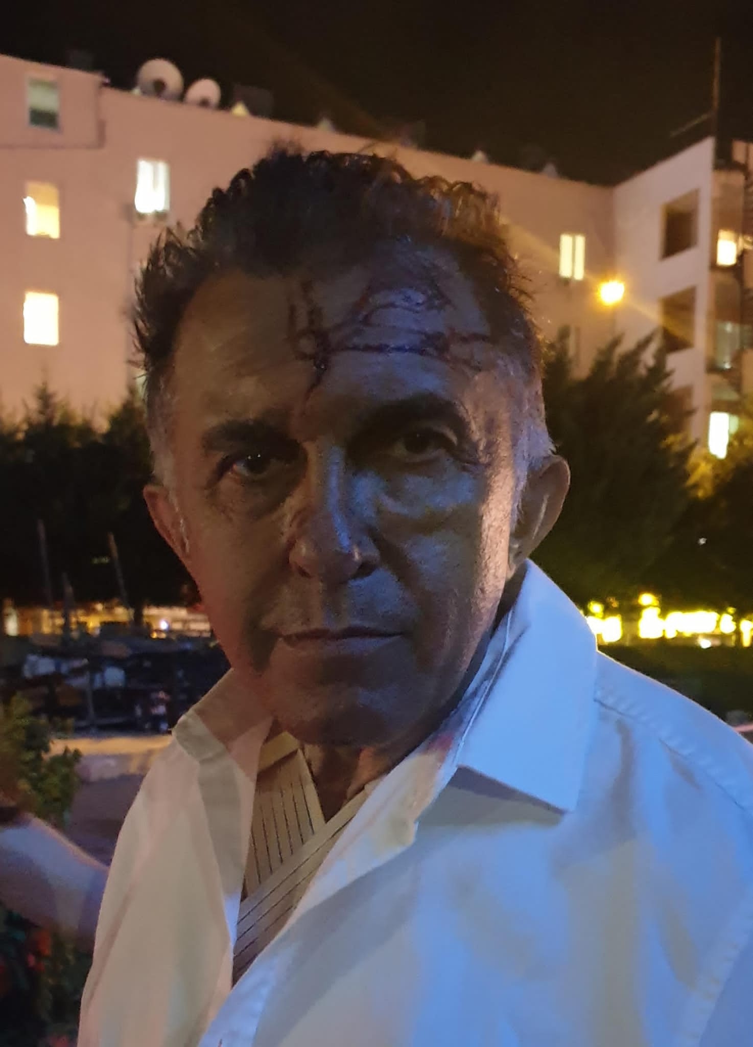 MUCİZE ADAM “DAHA VADEM DOLMAMIŞ!”