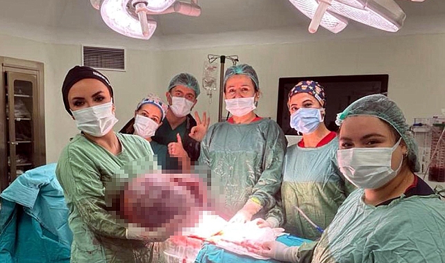 Karın şişliği için gitti, vücudundan 20 kiloluk kitle çıkarıldı