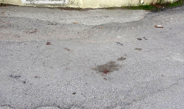 Okul önünde bacağından vuruldu