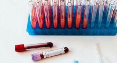 Sepsis: Hayati Tehlike Yaratan Sessiz Tehlike
