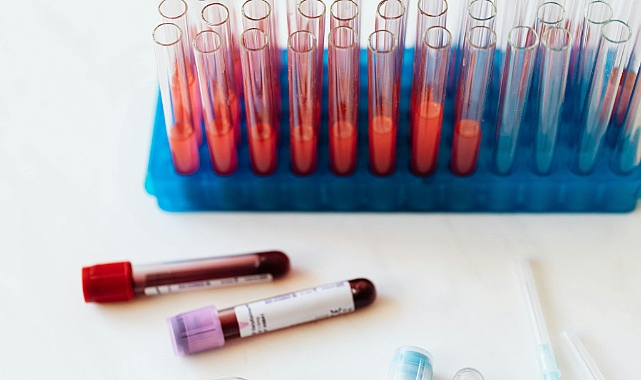 Sepsis: Hayati Tehlike Yaratan Sessiz Tehlike
